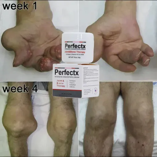 Fatima Abdullahi, Kano